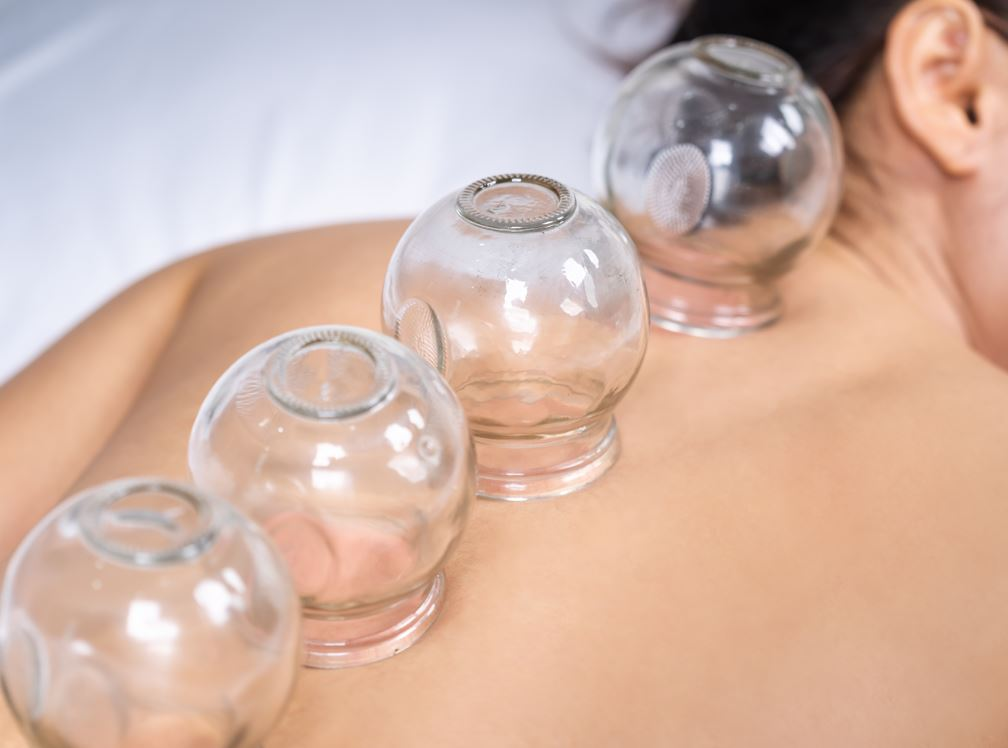 Cupping