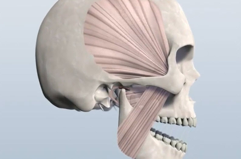 TMJ Disorders