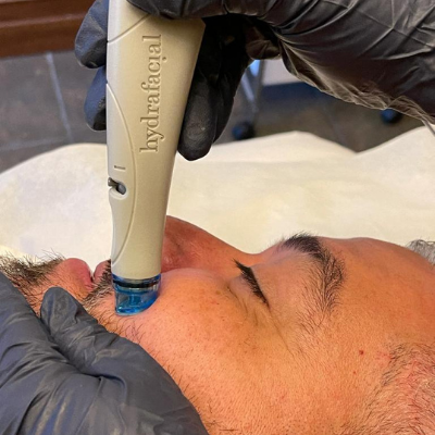 Hydrafacials
