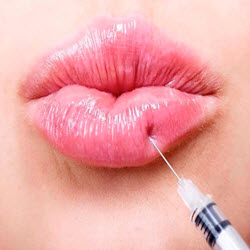 Lip fillers