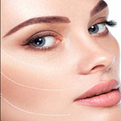Botox