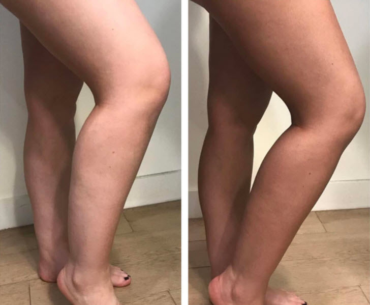 Spray Tan