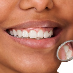 Gum Shaping