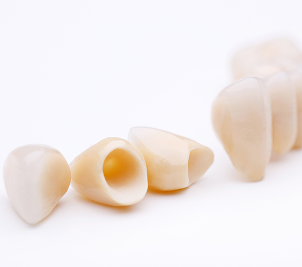 Dental Crowns