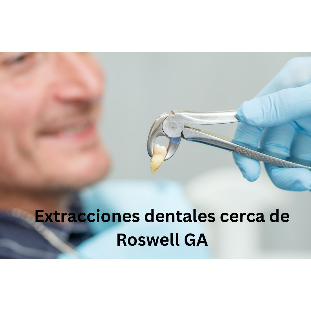 Extraccion Dental