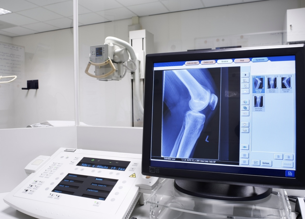 X-Rays