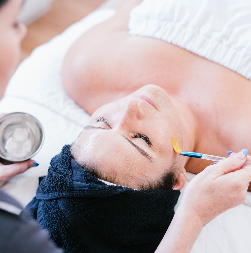 Chemical Peels