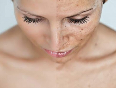 Facial Treatments