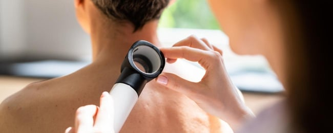 Melanoma Skin Cancer Care 