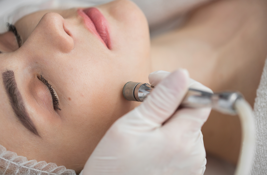 Microdermabrasion