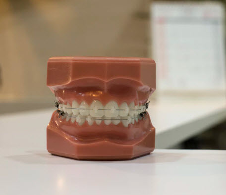 Dentures