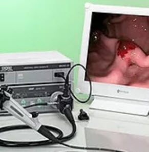 Endoscopy