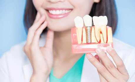 Multiple or Single Dental Implants