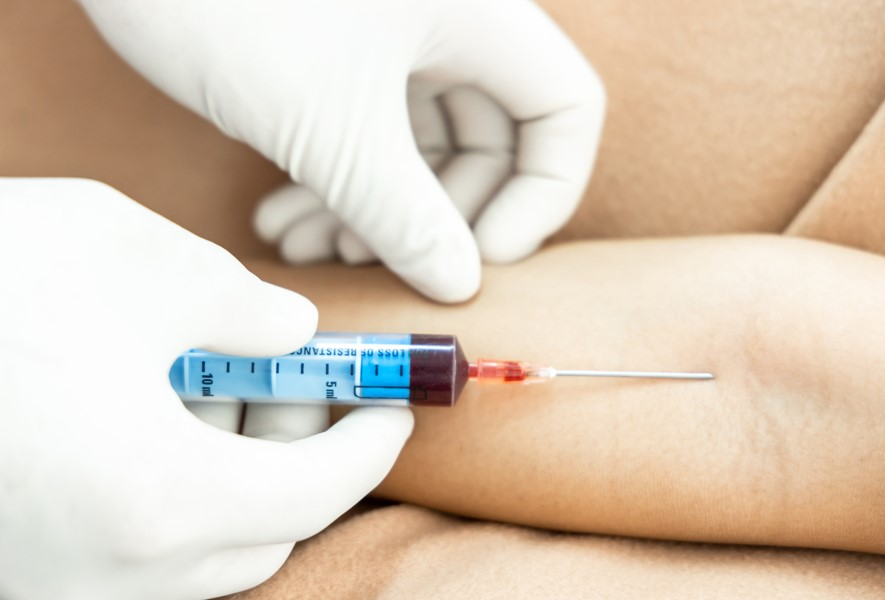 Mobile Blood Draw