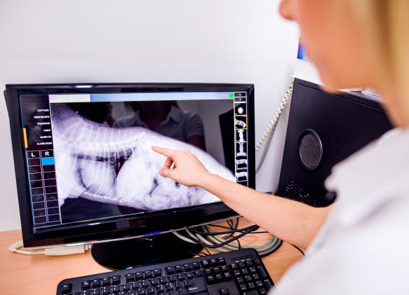 Digital X-ray