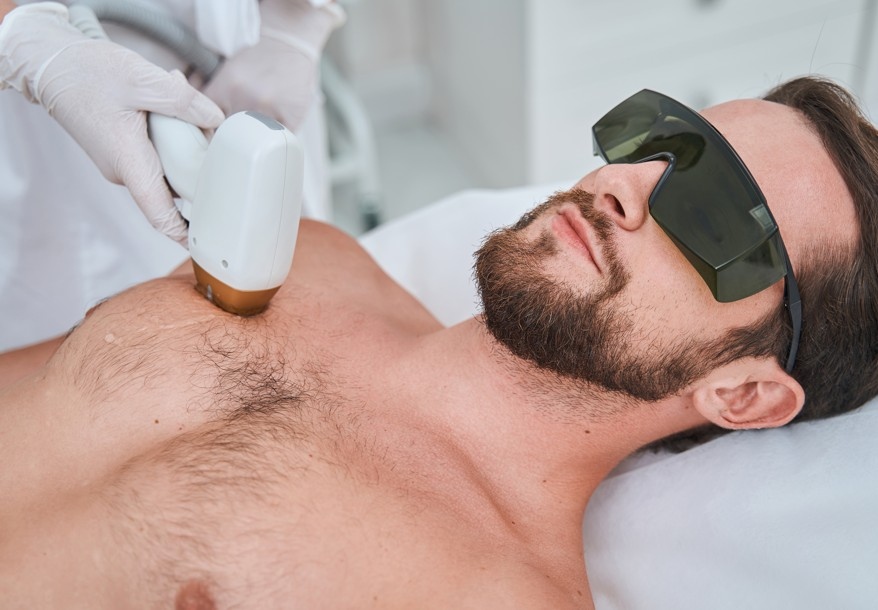 Laser Hair Removal