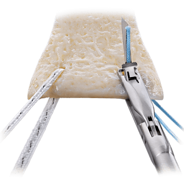Orthobiologics