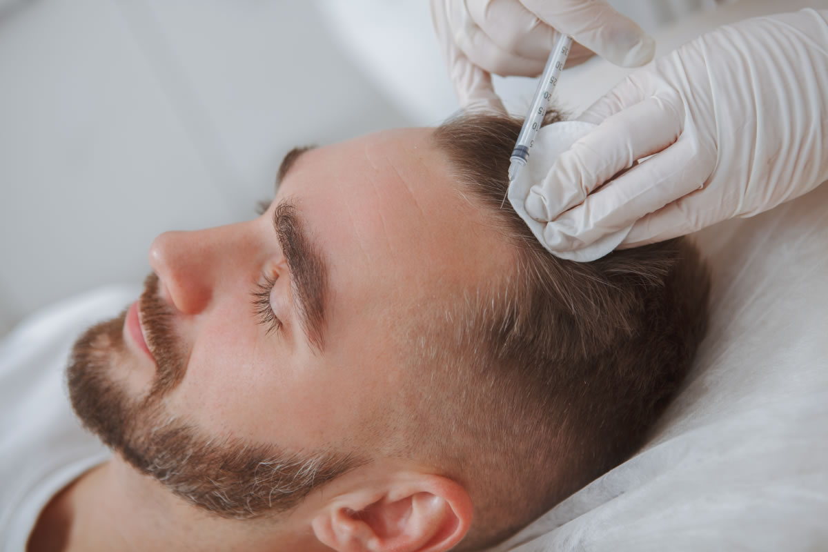 PRP For Hair Restoration