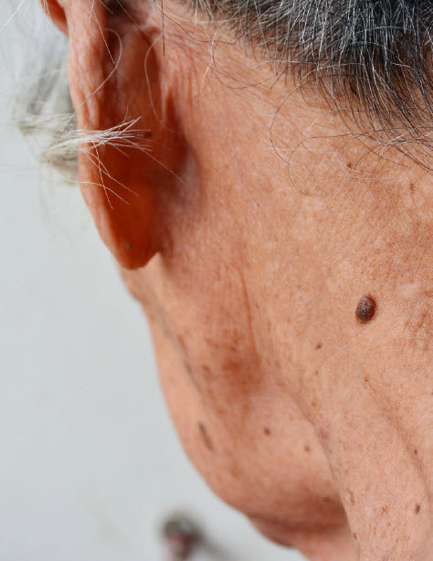 Medical Dermatology 