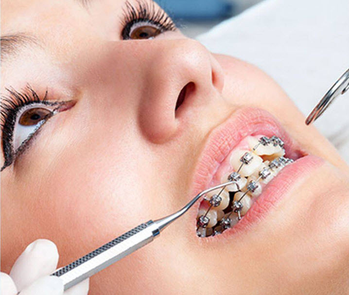 Orthodontics