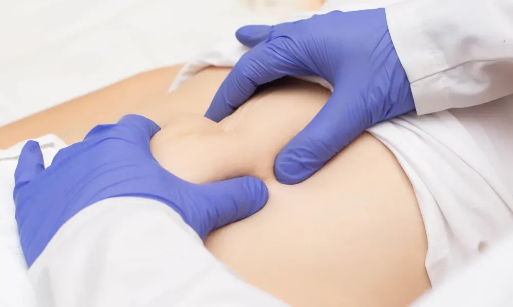 Hernias