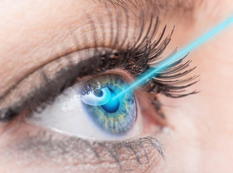 LASIK
