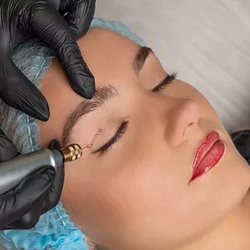 Fibroblast Skin Tightening