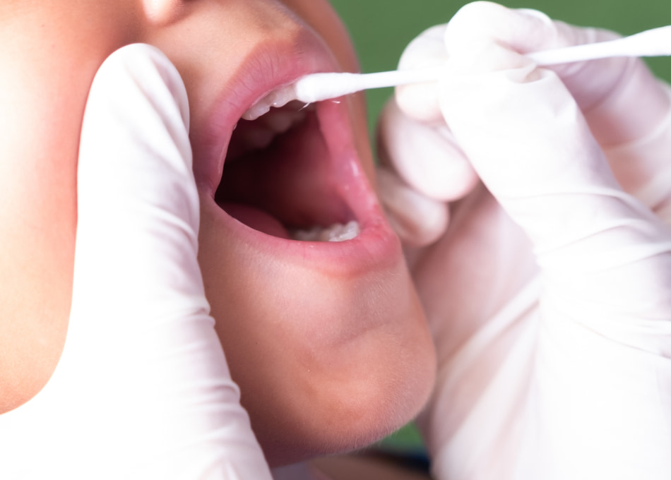 Fluoride Treatment