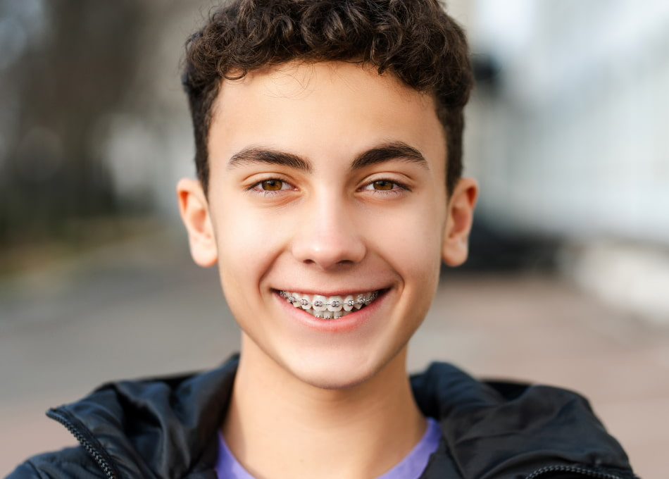 Traditional Braces