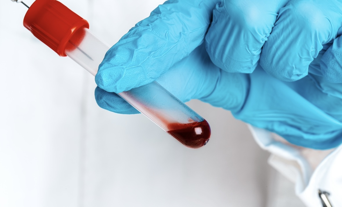 Bloodborne Pathogens Training (Online)