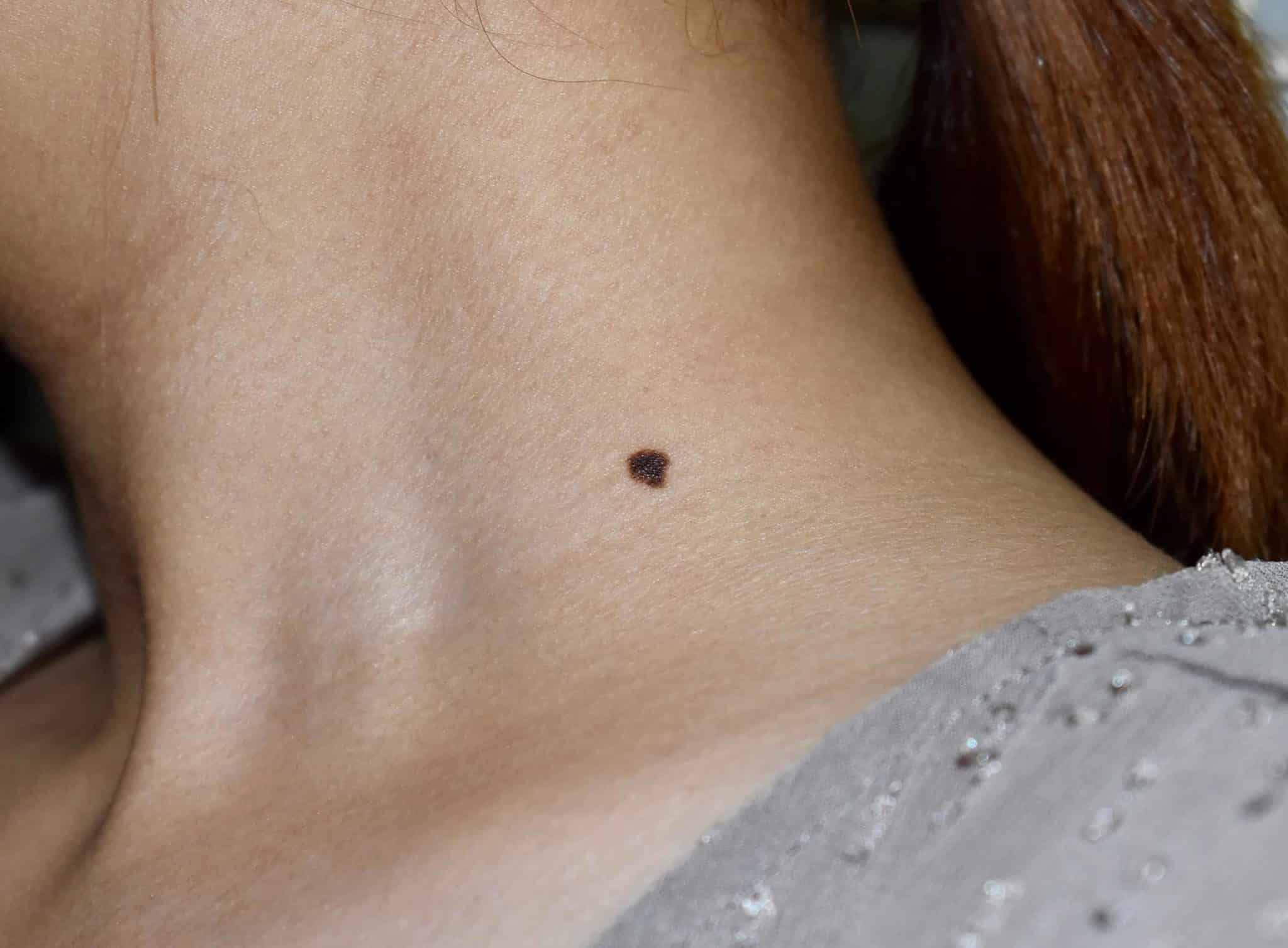 Moles
