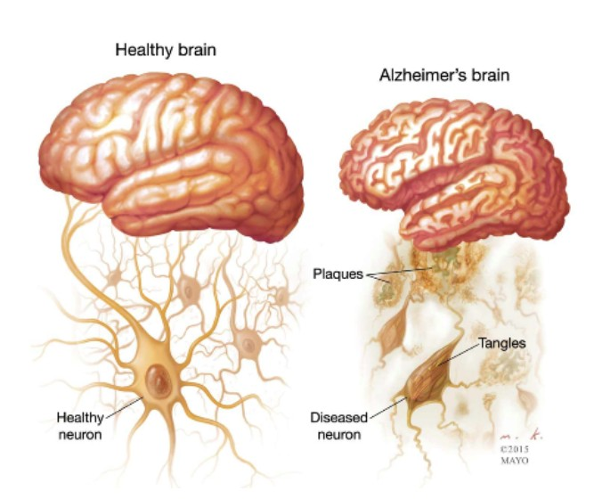 Treatment of Memory and Brain Disorders