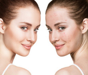 Before and After