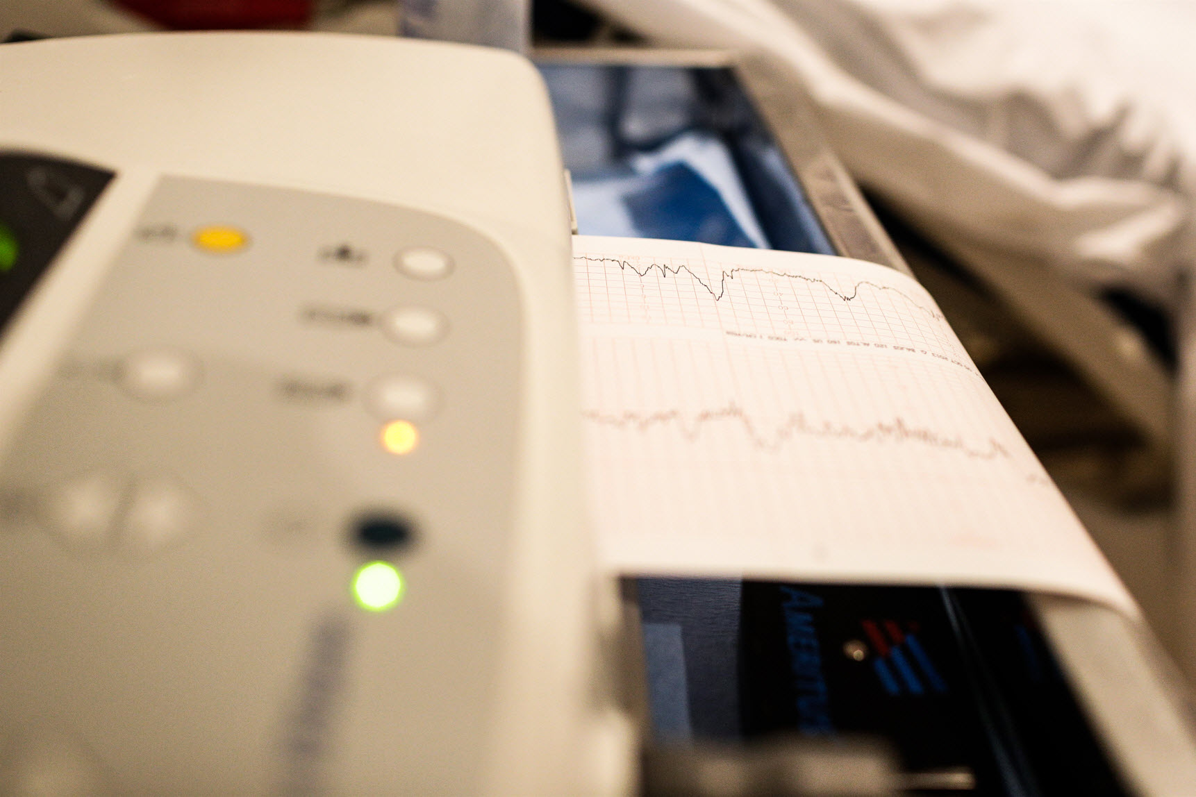 Arrhythmia Evaluation