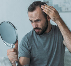 Hair Loss
