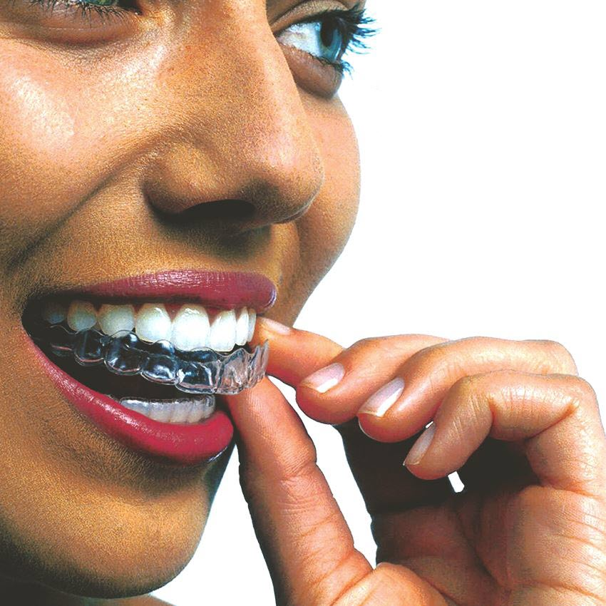 Invisalign Orthodontics