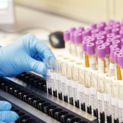 Laboratory Equipment Recycling