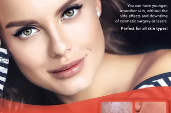 MicroNeedling