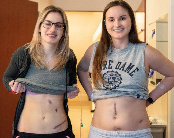 Organ Transplant
