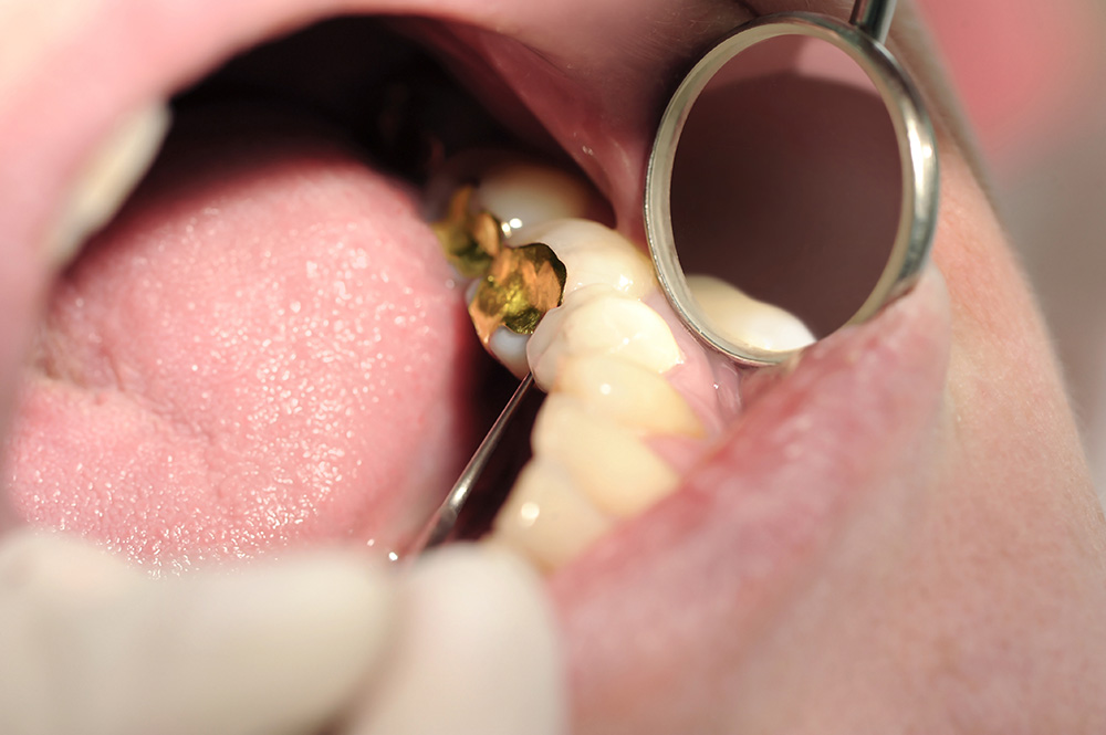 Restorative Dentistry