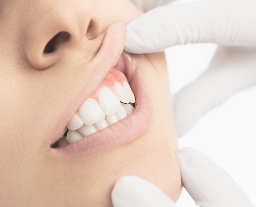 Periodontal Care