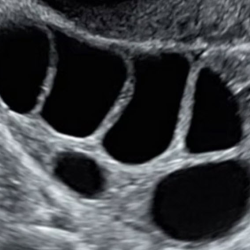 Ultrasound Bundle