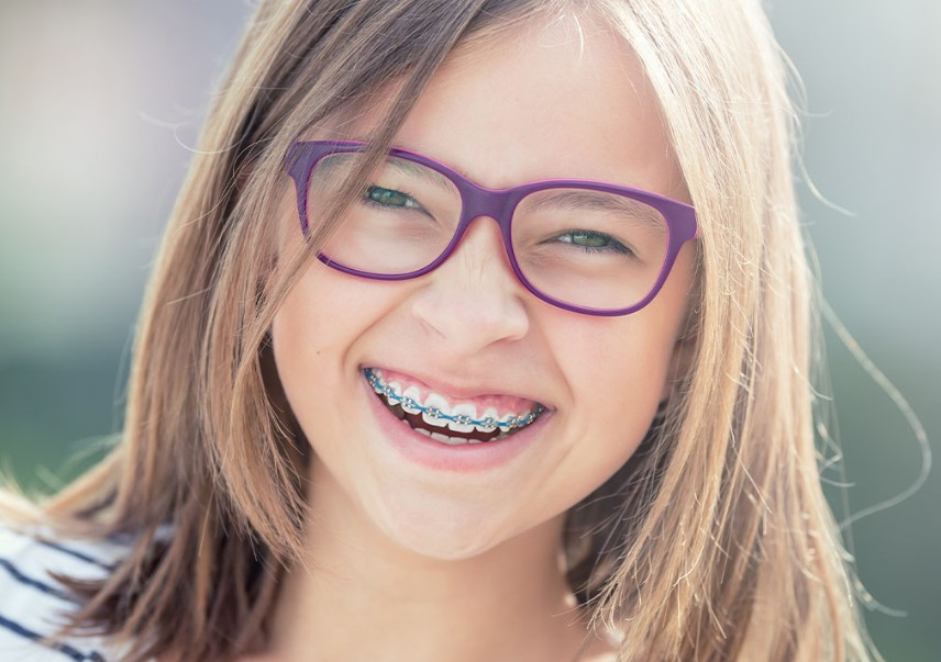 Metal Braces