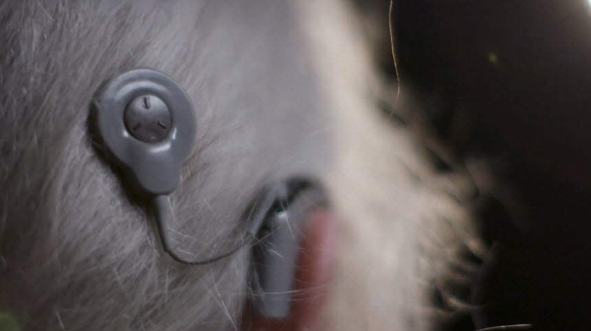 Cochlear Implants