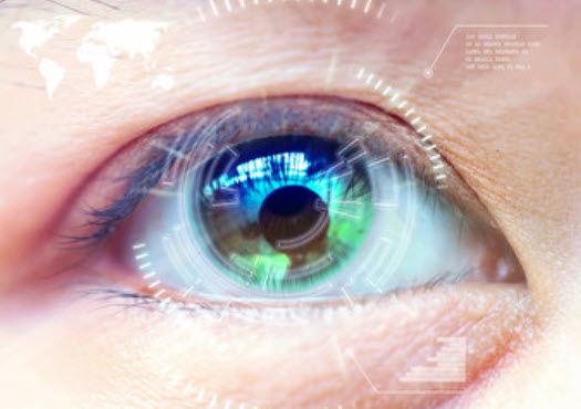 Lasik