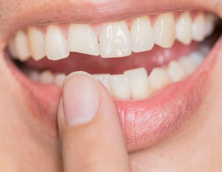 Restorative Dentistry