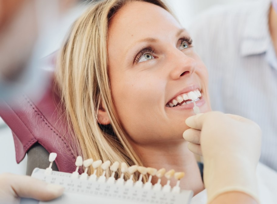 Veneers