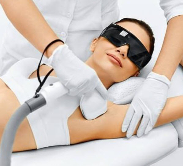 Laser hair removal