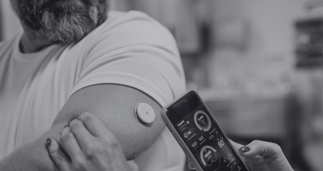Continuous Glucose Monitoring