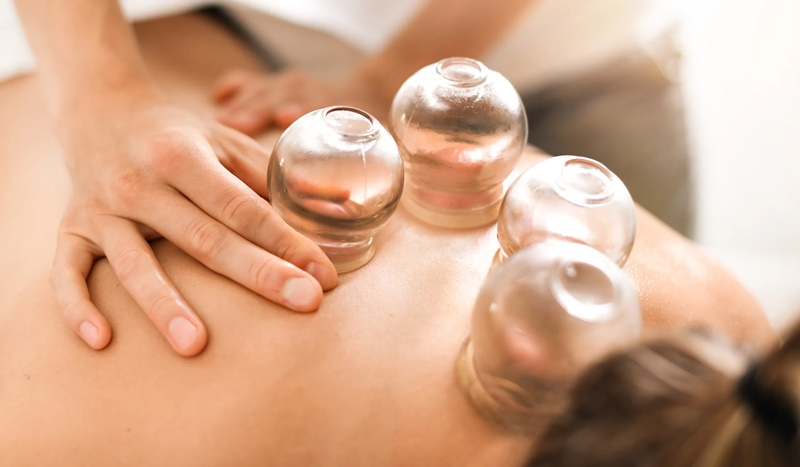 Cupping